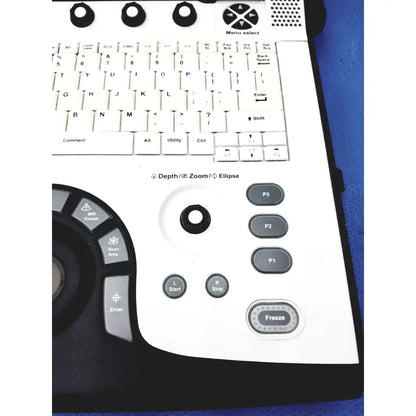GE Logiq E 5439035 Portable Ultrasound Machine Portable Ultrasound Machine, as-is (for parts) product photo 12