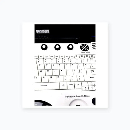 GE Logiq E 5439035 Portable Ultrasound Machine Portable Ultrasound Machine, as-is (for parts) product photo 10