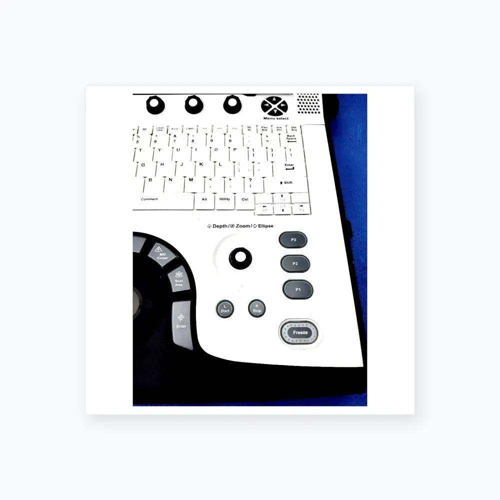 GE Logiq E 5439035 Portable Ultrasound Machine Portable Ultrasound Machine, as-is (for parts) product photo 12