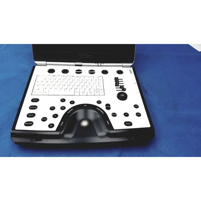 Black and white GE Vivid portable ultrasound machine with keyboard, circular buttons, and integrated trackball for mobile use