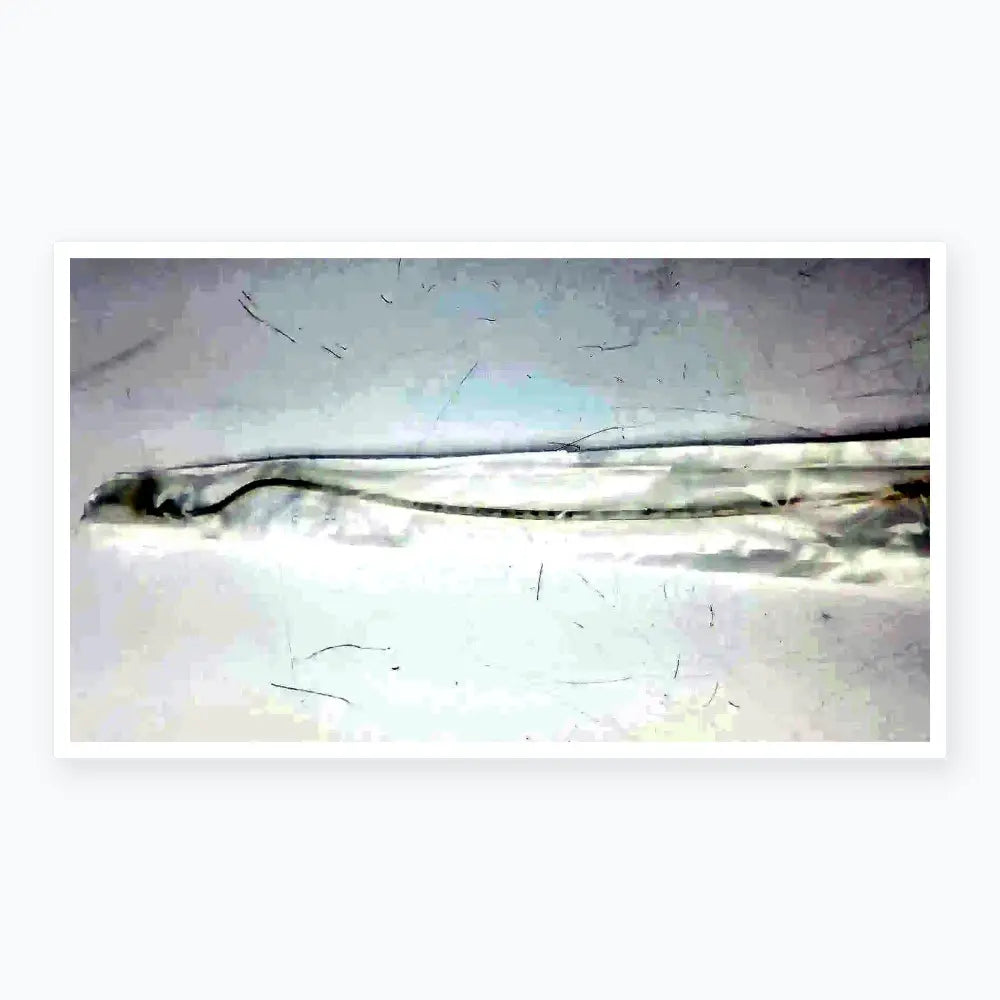 Vyaire AirLife Tri-Flo Suction Catheter, 14Fr (T260C X1) Suction Catheter, second-hand product photo 6