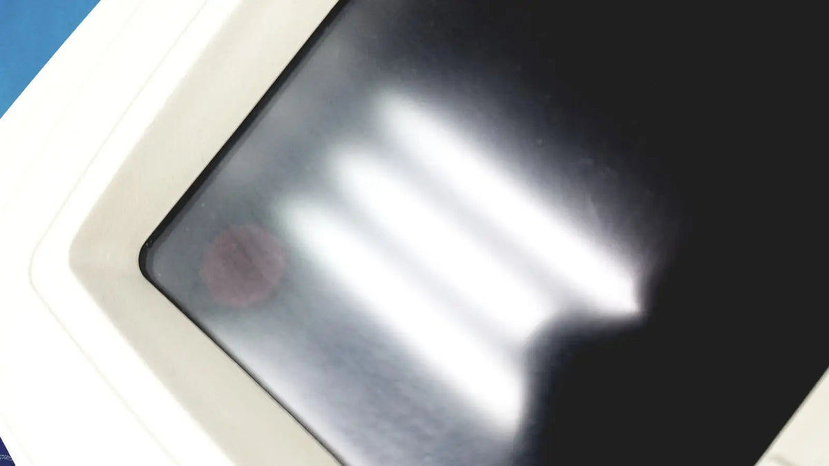 White-framed welch allyn cp 200 ekg ecg monitor displaying blurred vertical light streaks on digital screen