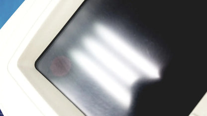 White-framed welch allyn cp 200 ekg ecg monitor displaying blurred vertical light streaks on digital screen