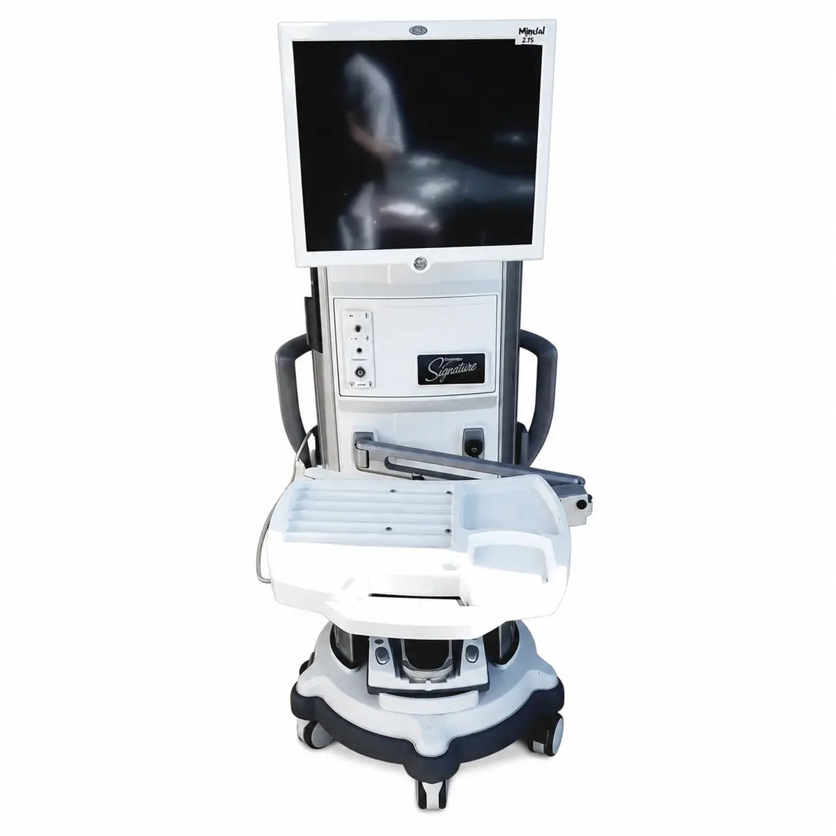 White and black mobile surgical cart with integrated monitor displaying medical imaging for whitestar signature phacoemulsifier with footswitch